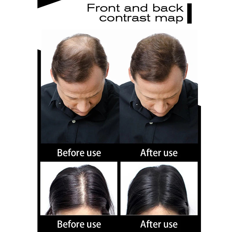 Sevich 100g Hair Fibers Refill Bag