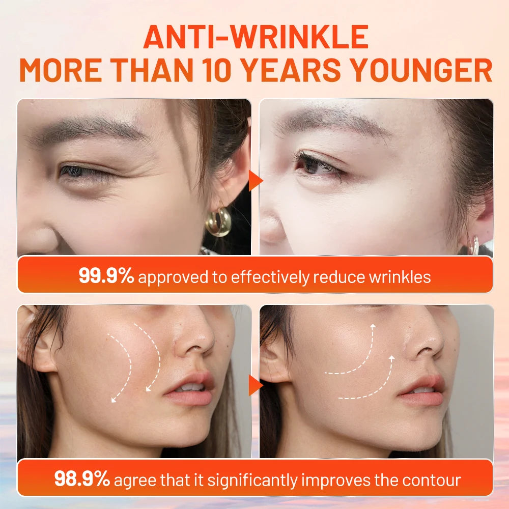 MeiYanQiong Natural Snail Essence with Hyaluronic Acid