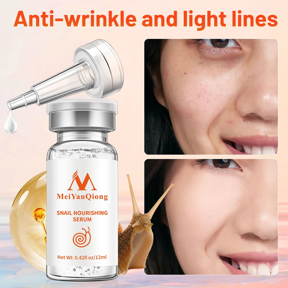 MeiYanQiong Natural Snail Essence with Hyaluronic Acid