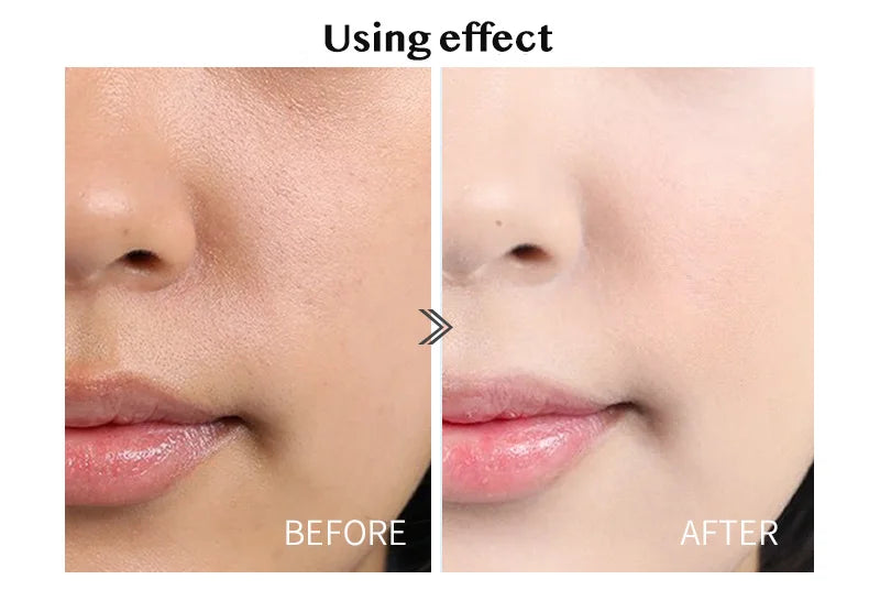 28 Bottles Hyaluronic Acid Revitalizer Serum