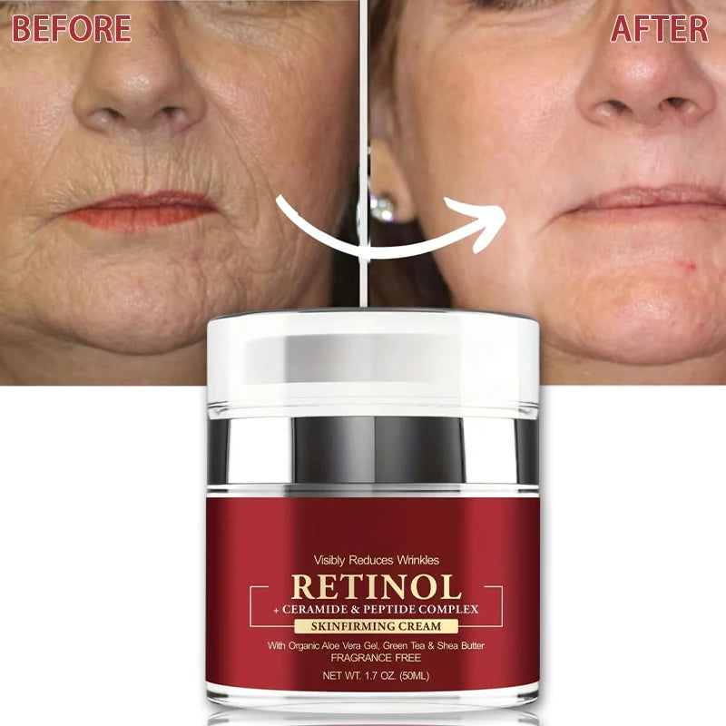 Instant Retinol Firming Cream