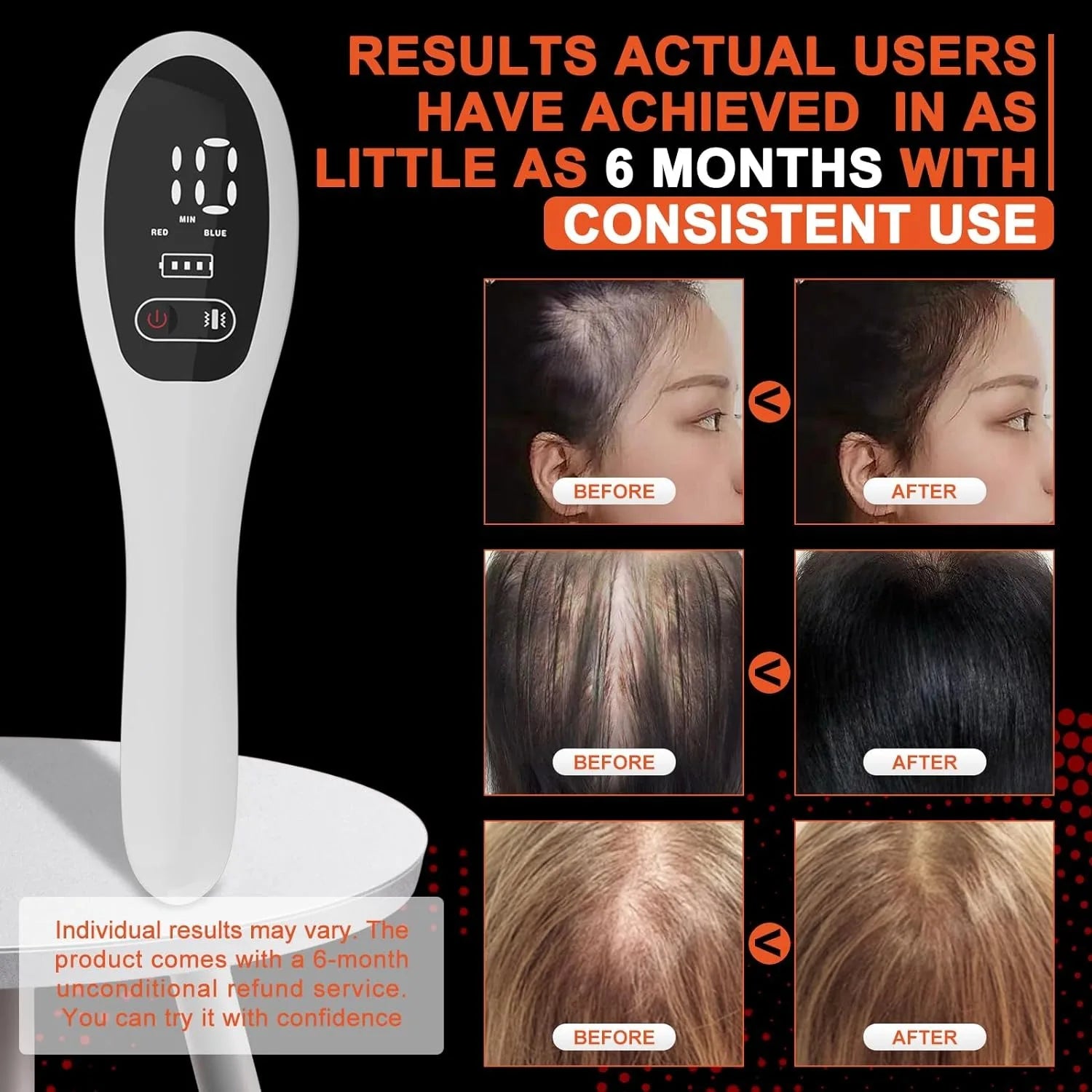 Electric Laser Hair Growth & Anti-Hair Loss Comb